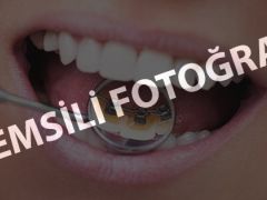 Güzel gülüşlerin sırrı koruyucu ortodonti olabilir!
